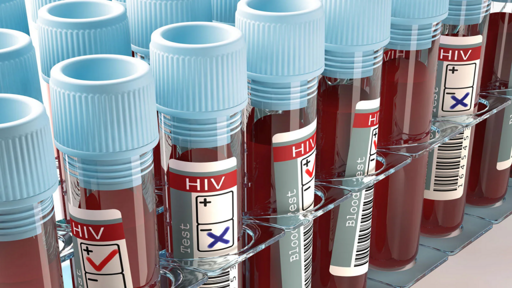 HIV-VIRUS.png